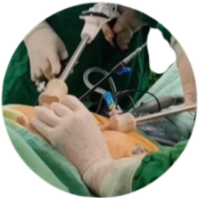 عمل لاپاراسکوپی و چاقی